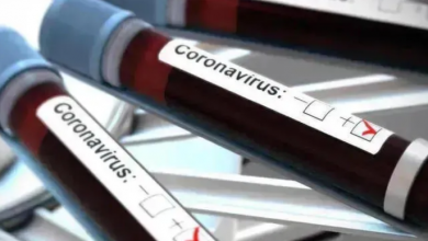 Photo of Georgia reports 159 new cases of coronavirus, 9 deaths
